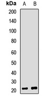 RPP25 Rabbit Polyclonal Antibody
