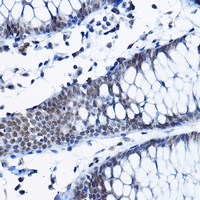Anti-RPP25 Antibody