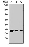 CD322 Rabbit Polyclonal Antibody