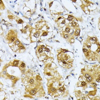 Anti-RagD Antibody