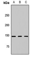 CSPP1 Rabbit Polyclonal Antibody