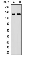 FTSJ3 Rabbit Polyclonal Antibody