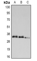 UCP2 Rabbit Polyclonal Antibody