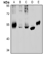 GABRB2 Antibody