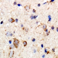 Anti-GABRB2 Antibody