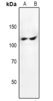 Focal Adhesion Kinase Rabbit Polyclonal Antibody