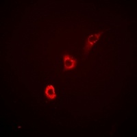 Anti-ITPKA Antibody