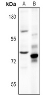 Chromogranin B Rabbit Polyclonal Antibody