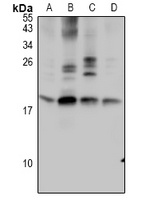 TF2A2 Rabbit Polyclonal Antibody