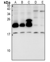 Cytochrome b5B Rabbit Polyclonal Antibody