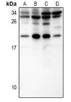 IL-15 Rabbit Polyclonal Antibody