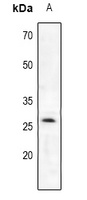 Trypsin 2 Rabbit Polyclonal Antibody