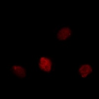 MKI67 antibody