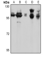 mGLUR7 Rabbit Polyclonal Antibody