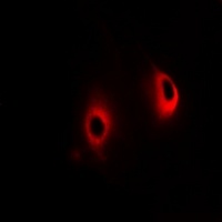 Anti-mGLUR7 Antibody