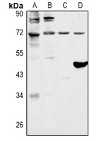 FOXO1 Antibody