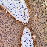 FOXO1 Antibody