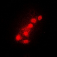 FOXO1 Antibody