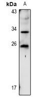 TIG1 Rabbit Polyclonal Antibody