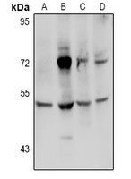Transglutaminase 3 Rabbit Polyclonal Antibody