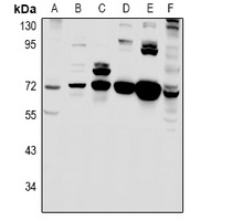 MIC1 Rabbit Polyclonal Antibody