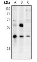 ZNF392 Rabbit Polyclonal Antibody