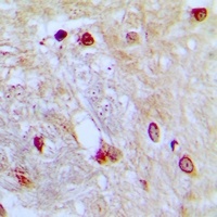Anti-ZNF392 Antibody