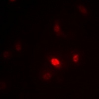 Anti-ZNF392 Antibody