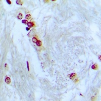 ZNF287 antibody