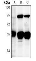 DUS2L Rabbit Polyclonal Antibody