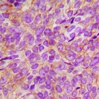 EGFR Antibody