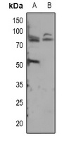 ADAM12-S Rabbit Polyclonal Antibody