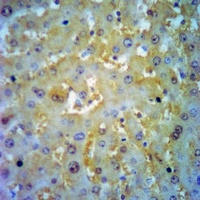 ADAM12-S Rabbit Polyclonal Antibody
