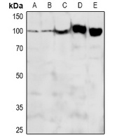 ADAM12-L Rabbit Polyclonal Antibody