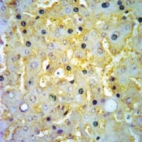 ADAM12-L Rabbit Polyclonal Antibody