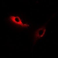 Anti-KSR2 Antibody