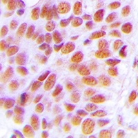 Anti-NOL10 Antibody