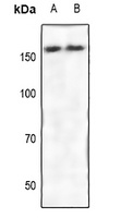 ROCK2 Rabbit Polyclonal Antibody