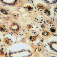 Anti-CEP95 Antibody