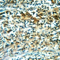 CNGA1 antibody