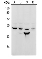 NuSAP Rabbit Polyclonal Antibody