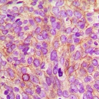 CEP55 antibody