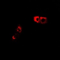 Anti-GPR66 Antibody