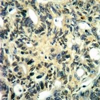 Anti-MNK2 (Phospho-T249) Antibody