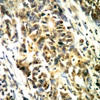 Anti-LAT (Phospho-Y161) Antibody