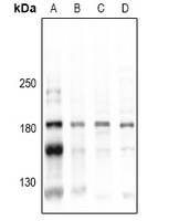 CD45 (Phospho-Y1216) Antibody