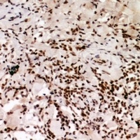 Anti-HP1 alpha (Phospho-S92) Antibody