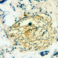 Anti-nNOS (Phospho-S1417) Antibody