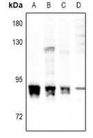 PKC alpha (Phospho-S657) Antibody