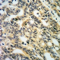 PKC alpha (Phospho-S657) Antibody